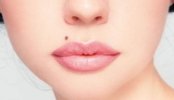 人為什么會(huì)長(zhǎng)痣,痣越來(lái)越多怎么辦