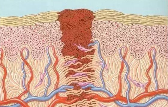 為什么傷口愈合時(shí)會(huì)感覺(jué)癢,傷口愈合特別癢怎么辦