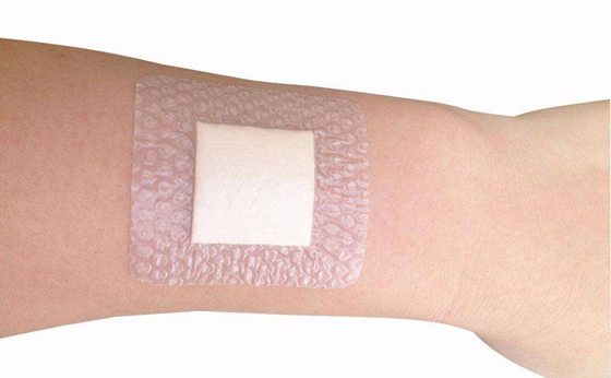 為什么傷口愈合時(shí)會(huì)感覺(jué)癢,傷口愈合特別癢怎么辦