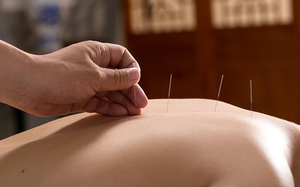 針灸為什么能治病,針灸治病的原理是什么