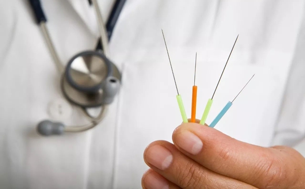 針灸為什么能治病,針灸治病的原理是什么